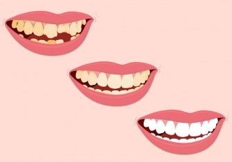 Dentisterie esthétique